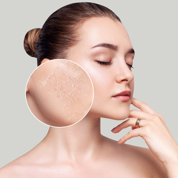 Skin Concerns - Dry Skin