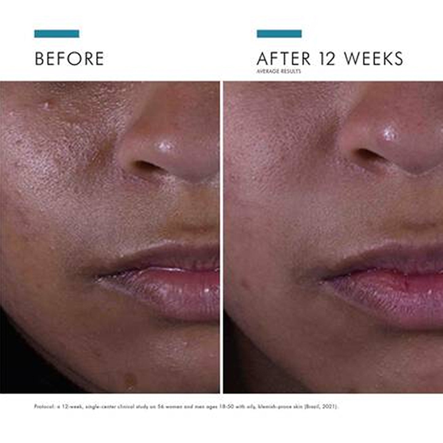 SKINCEUTICALS BREAKOUT DUO