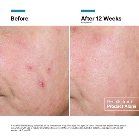 SkinCeuticals: Advanced RGN-6