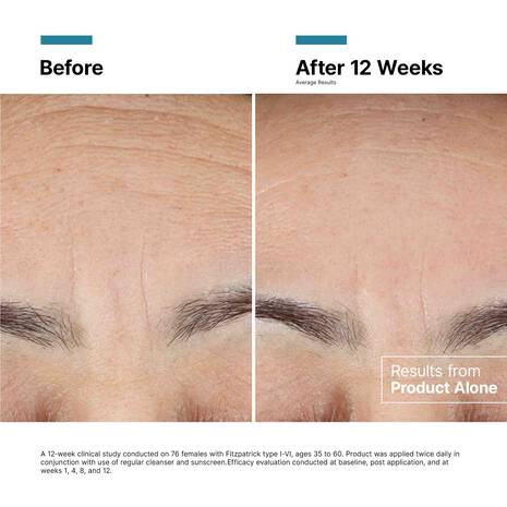 SkinCeuticals: Advanced RGN-6