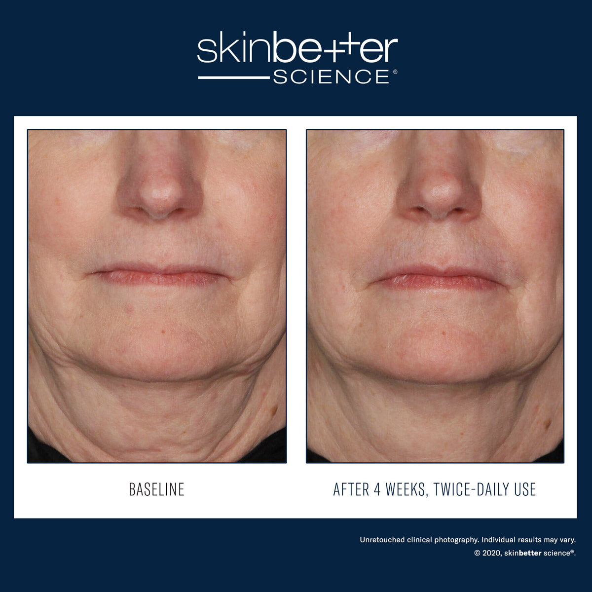 Skinbetter Science : Crème de soin InterFuse VISAGE & COU 30 ml