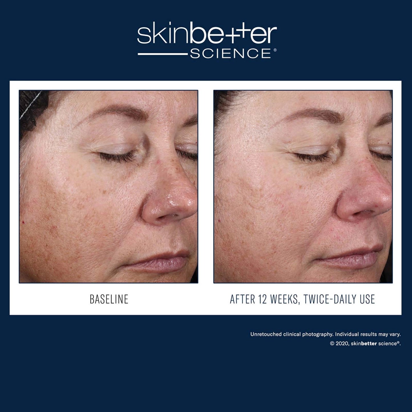 Skinbetter Science : Sérum Défense et Réparation Avancé Alto 30 ml