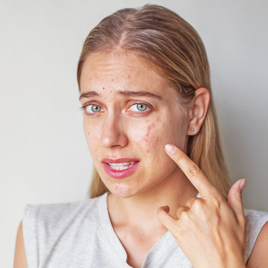 5 Soothing Skincare Products to Relieve Seasonal Allergies and Keep Your Skin Happy