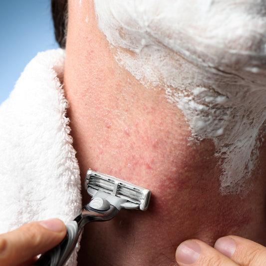 Effortless Skincare: PCA Skin Blemish Treatment for Men, Your Key to a Razor Bump and Ingrown Hair-Free Life