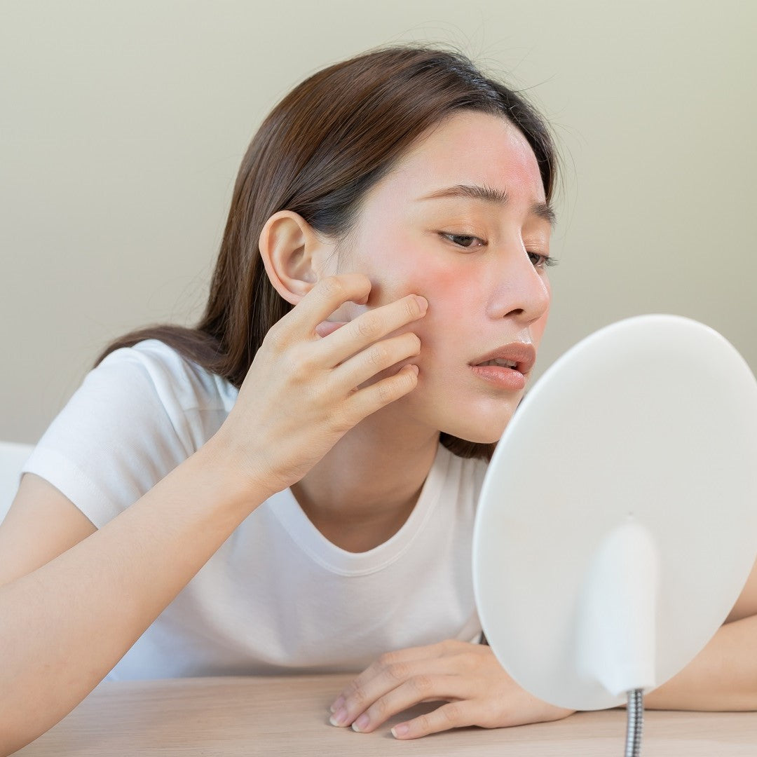 Common Facial Skin Concerns and How to Treat Them
