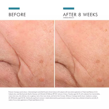 SkinCeuticals: Triple Lipid Restore 2:4:2 15ml | GWP