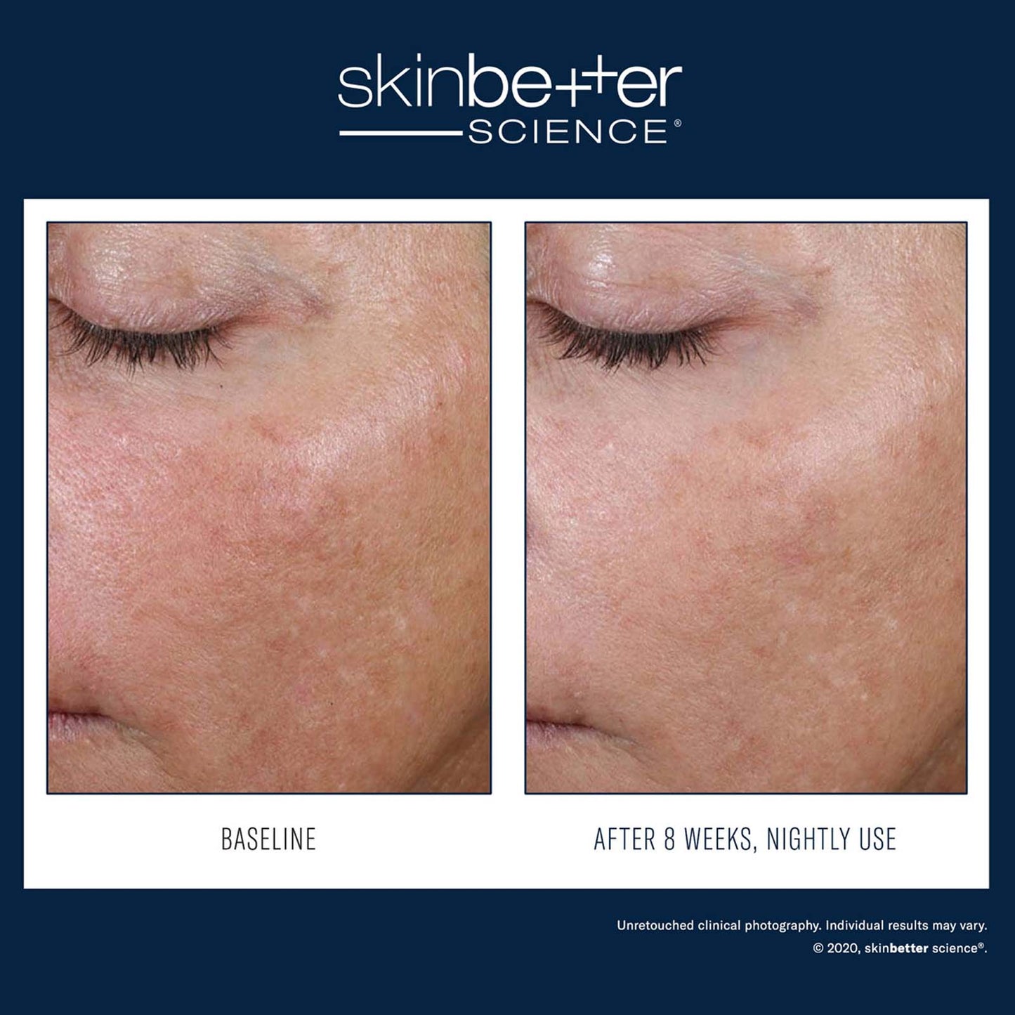 Skinbetter Science : Crème de nuit AlphaRet 30 ml