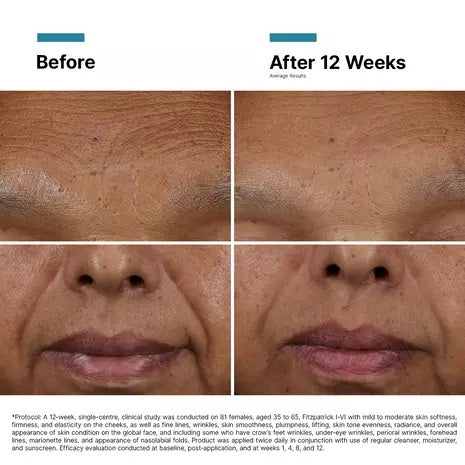 SkinCeuticals: H.A. Intensifier Multi-Glycan 15ml GWP