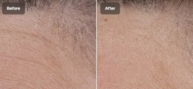 ZO Skin Health Wrinkle + Texture 0.3% 50 ml / 1.7 fl oz