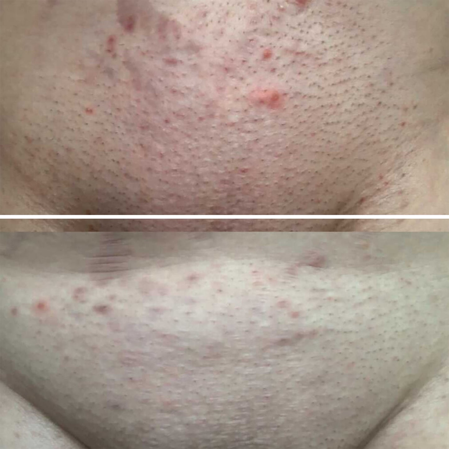 BushBalm: Sweet Escape Ingrown Hair Oil