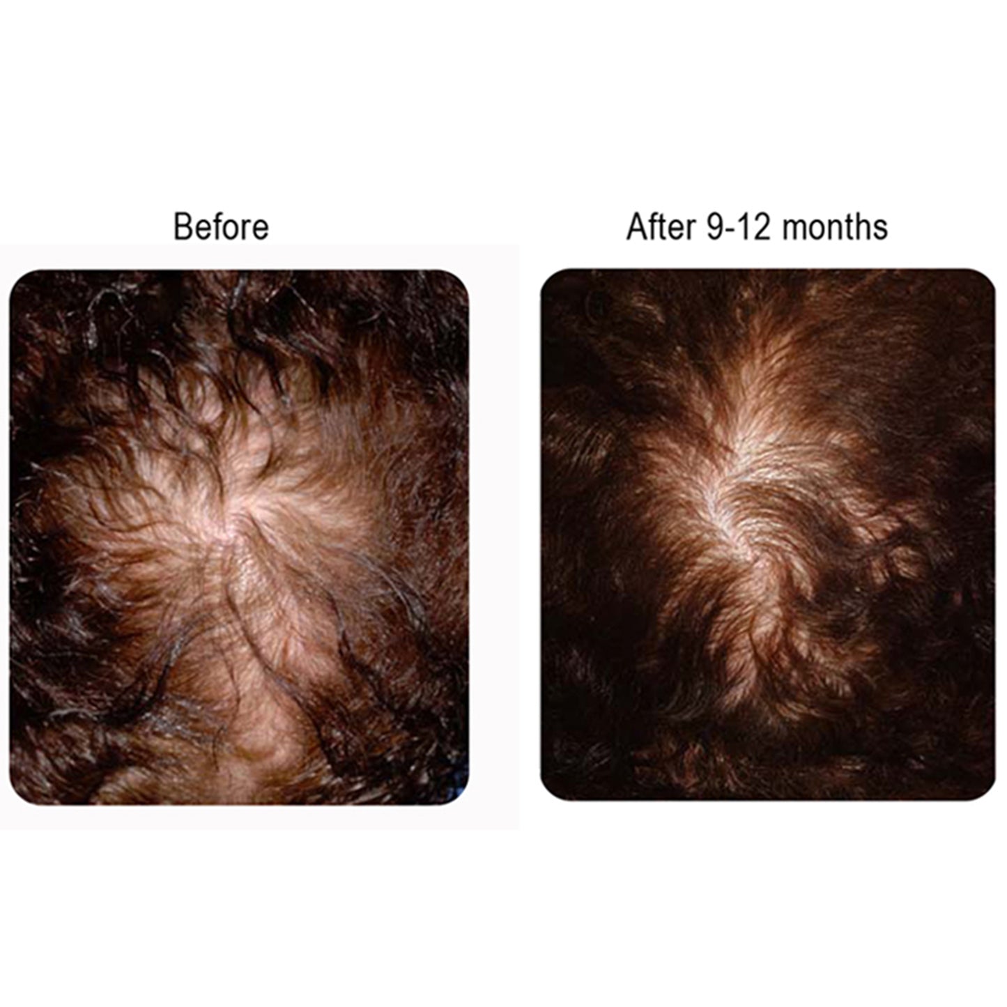 SHAMPOOING + APRÈS-SHAMPOOING + TRAITEMENT BIO-NETTOYANTS REVIVOGEN PRO