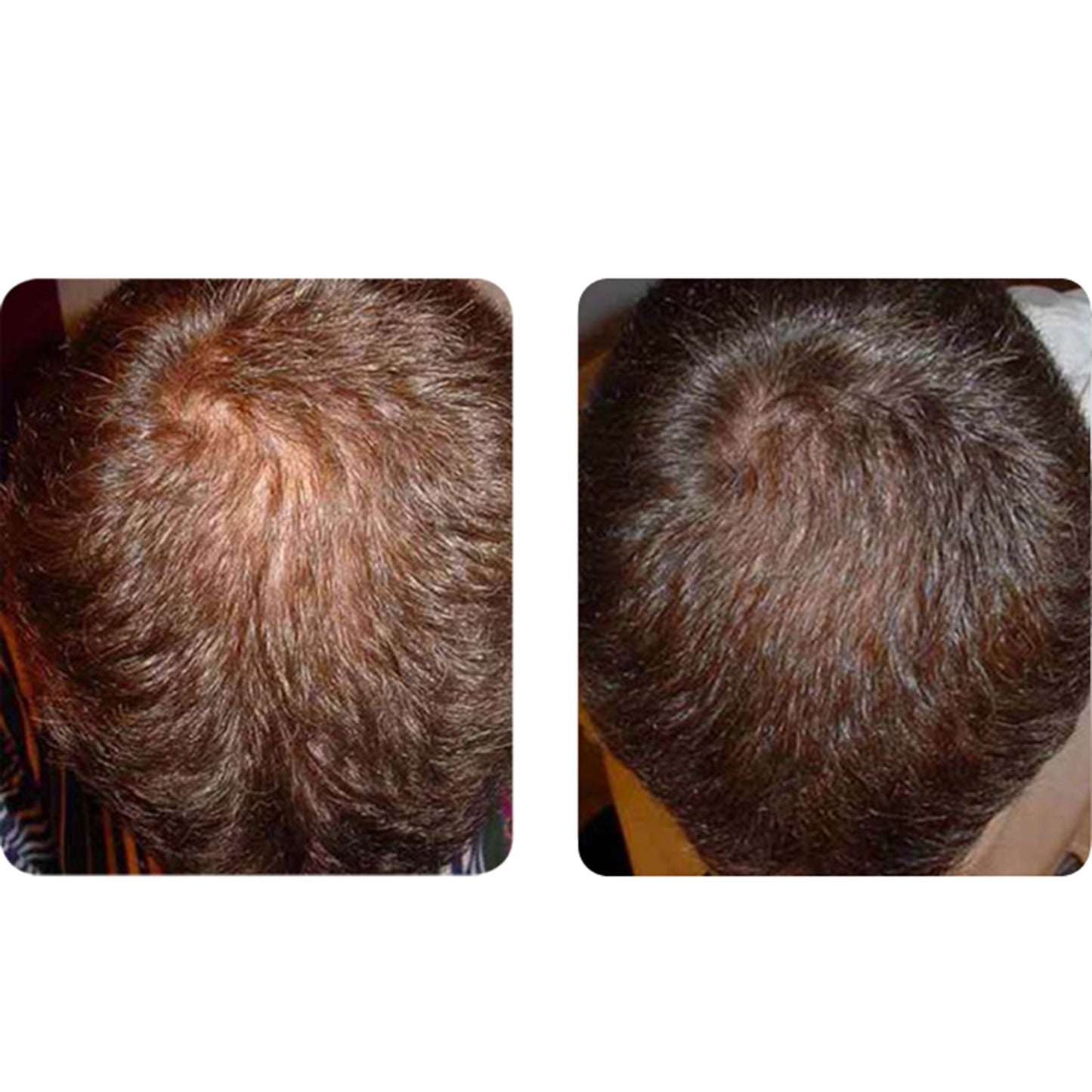 SHAMPOOING + APRÈS-SHAMPOOING + TRAITEMENT BIO-NETTOYANTS REVIVOGEN PRO